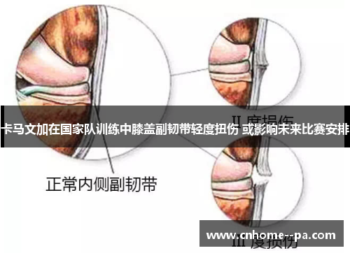 卡马文加在国家队训练中膝盖副韧带轻度扭伤 或影响未来比赛安排 卡马文加在国家队训练中膝盖副韧带轻度扭伤 或影响未来比赛安排